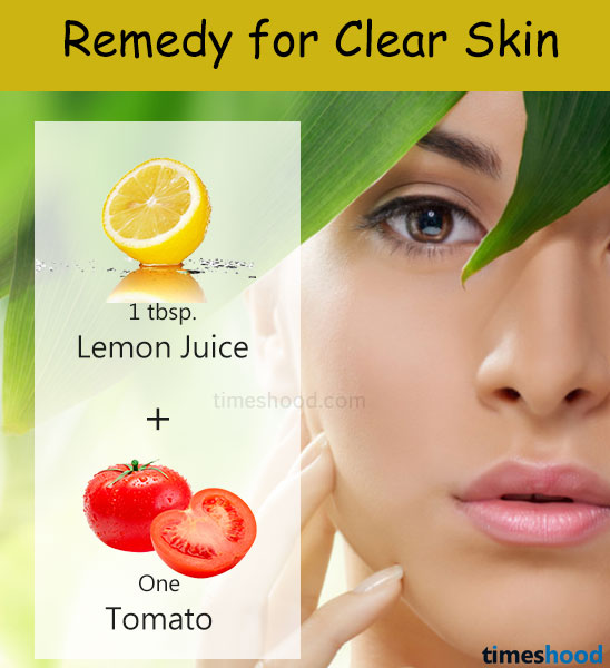 How to get clear skin? Tomato Lemon mask for dark spots, scars. Homemade tips for clear skin.
